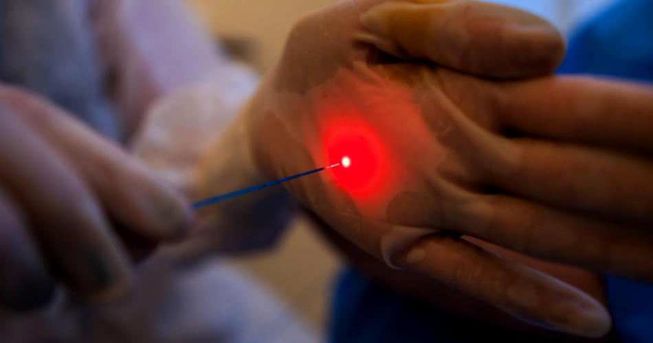 uso do laser em ginecologia e proctologia